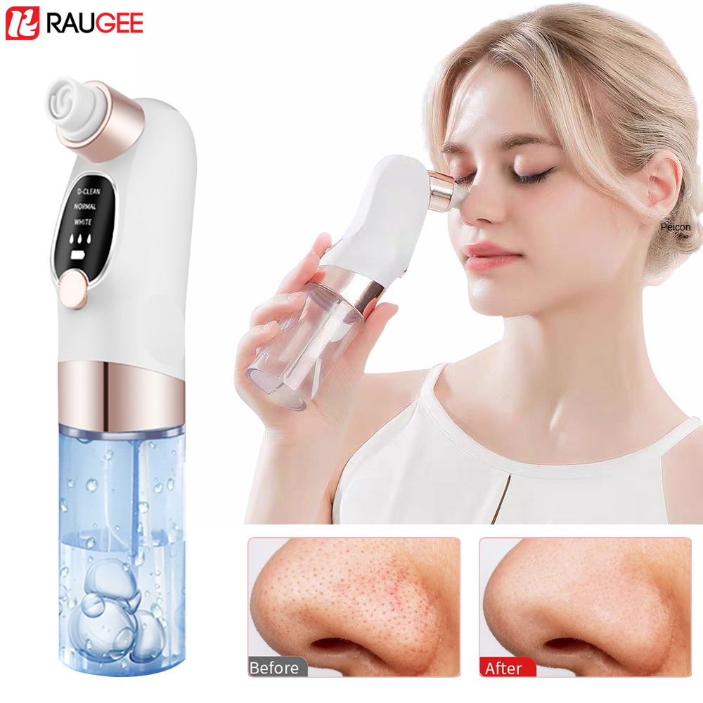 Blackhead Remover Electric Bla - Nasal Aspirator 评论和价格