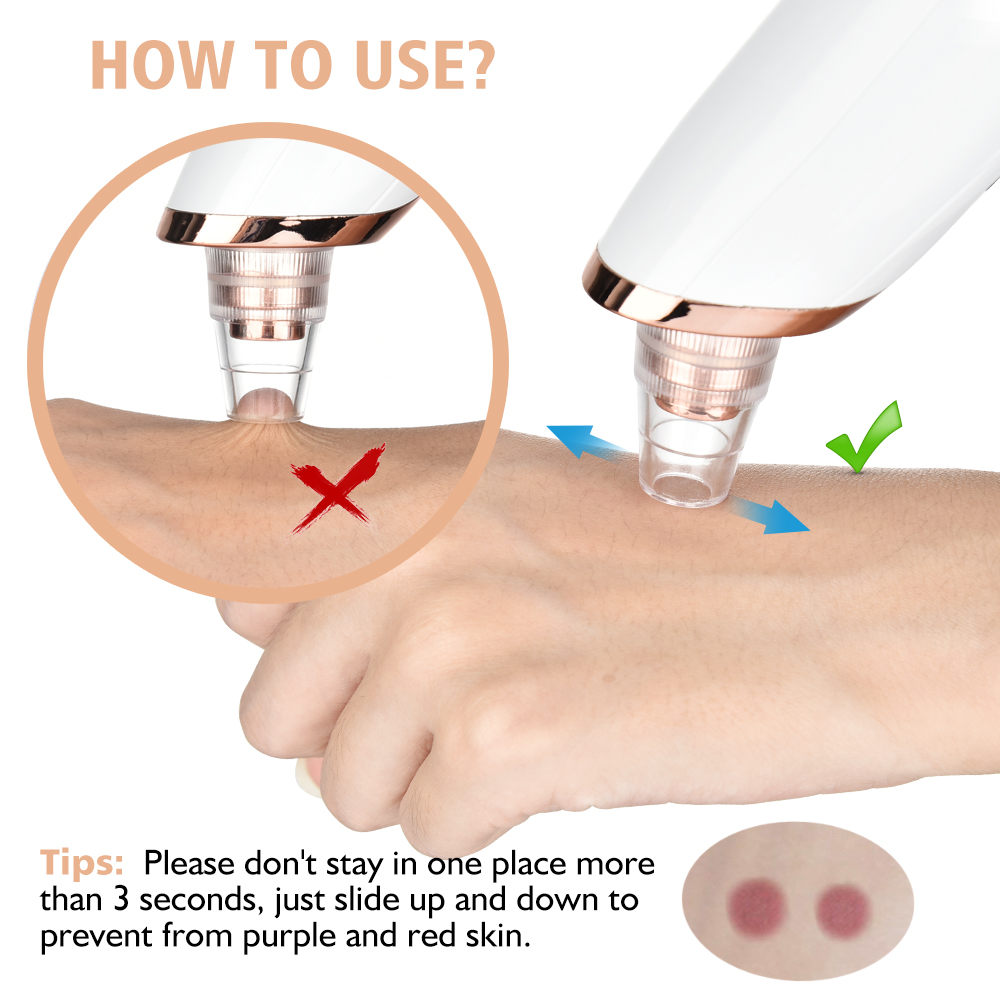 Blackhead Remover Vacuum Pore  - Nasal Aspirator 评论和价格